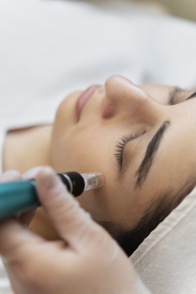 Al Malika, séance de Microneedling